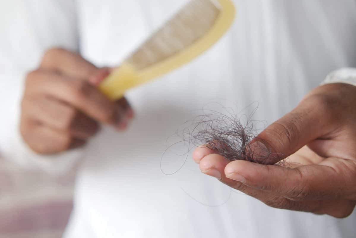 Injections PRP : un traitement antichute de cheveux