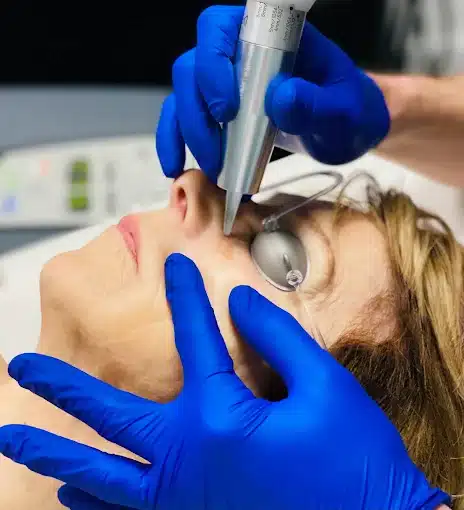 Quels traitements lasers sont possibles en hiver ?